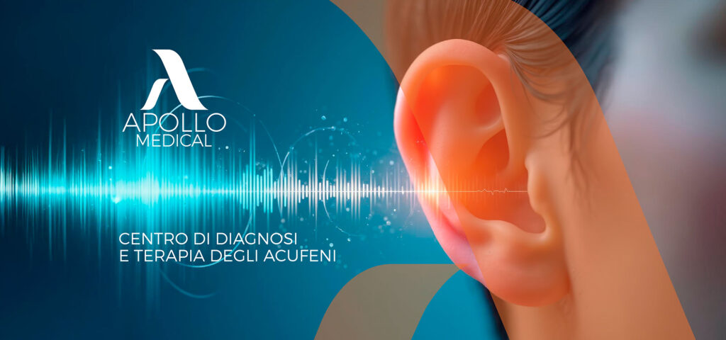 Acufene - Siracusa, Sicilia
